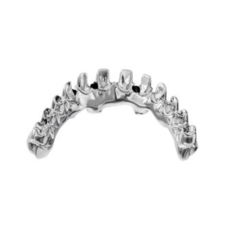 Personalized Bridge Frame